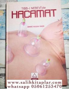 Tıbbı Nebevi'de Hacamat Tıbbı Nebevi'de Hacamat